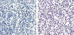 Anti-GATA4 (phospho Ser105) antibody used in IHC (Paraffin sections) (IHC-P). GTX25245