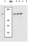 Anti-NFAT1 (phospho Ser54) antibody used in Western Blot (WB). GTX25246
