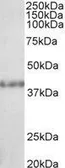 Anti-SUV39H2 antibody, C-term used in Western Blot (WB). GTX25264