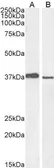 Anti-MEL18 antibody, C-term used in Western Blot (WB). GTX25267