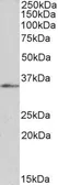 Anti-FOXB1 antibody, C-term used in Western Blot (WB). GTX25274
