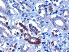 Anti-FBXW2 antibody, C-term used in IHC (Paraffin sections) (IHC-P). GTX25309