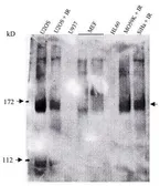 Anti-FANCD2 antibody [FI-17] used in Western Blot (WB). GTX25360