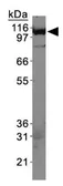 Anti-HIP1 antibody [4B10] used in Western Blot (WB). GTX25402