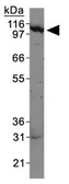 Anti-HIP1 antibody [1B11] used in Western Blot (WB). GTX25403