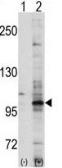 Anti-EphA7 antibody used in Western Blot (WB). GTX25411