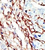 Anti-EphA7 antibody used in IHC (Paraffin sections) (IHC-P). GTX25411
