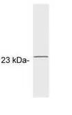 Anti-GCAP1 antibody [G2] used in Western Blot (WB). GTX25420