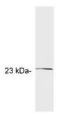 Anti-GCAP2 antibody [A1] used in Western Blot (WB). GTX25422