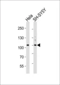 Anti-VPS34 antibody used in Western Blot (WB). GTX25451