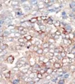 Anti-PI3 kinase p150 antibody used in IHC (Paraffin sections) (IHC-P). GTX25459