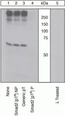 Anti-SMAD2 (phospho Thr8) antibody used in Western Blot (WB). GTX25487