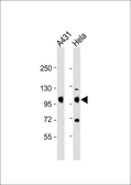 Anti-IGF1R antibody used in Western Blot (WB). GTX25497