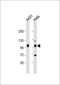 Anti-IGF1R beta antibody used in Western Blot (WB). GTX25497