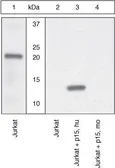 Anti-Bid (p15-specific ) antibody used in Western Blot (WB). GTX25498