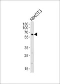 Anti-RYK antibody used in Western Blot (WB). GTX25513