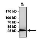 Anti-HSP27 (phospho Ser15) antibody used in Immunoprecipitation (IP). GTX25581