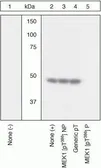 Anti-MEK1 (phospho Thr386) antibody used in Western Blot (WB). GTX25615