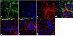Anti-EGFR (phospho Tyr1068) antibody used in Immunocytochemistry/ Immunofluorescence (ICC/IF). GTX25644