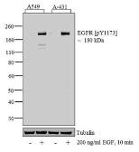 Anti-EGFR (phospho Tyr1086) antibody used in Western Blot (WB). GTX25650