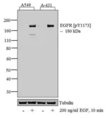 Anti-EGFR (phospho Tyr1086) antibody used in Western Blot (WB). GTX25650