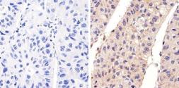 Anti-EGFR (phospho Tyr1173) antibody used in IHC (Paraffin sections) (IHC-P). GTX25652