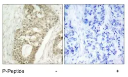 Anti-PKC delta (phospho Ser645) antibody used in IHC (Paraffin sections) (IHC-P). GTX25657