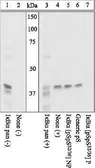 Anti-IKB alpha (phospho Ser32/Ser36) antibody used in Western Blot (WB). GTX25682