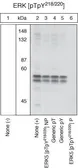 Anti-ERK5 (phospho Thr218/Tyr220) antibody used in Western Blot (WB). GTX25686