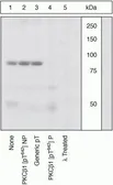 Anti-PKC beta 1 (phospho Thr642) antibody used in Western Blot (WB). GTX25782