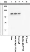 Anti-PKC beta (phospho Thr500) antibody used in Western Blot (WB). GTX25817