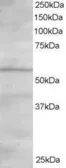 Anti-OSBPL2 antibody, C-term used in Western Blot (WB). GTX25921