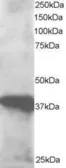 Anti-GIPC3 antibody, N-term used in Western Blot (WB). GTX25950