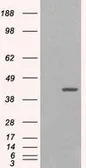 Anti-GIPC1 antibody, C-term used in Western Blot (WB). GTX25951