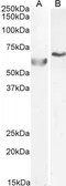 Anti-DNA polymerase lambda antibody, C-term used in Western Blot (WB). GTX25954