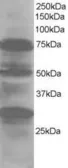 Anti-LMO7 antibody, Internal used in Western Blot (WB). GTX25955