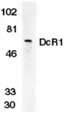 Anti-DcR1 antibody used in Western Blot (WB). GTX25975