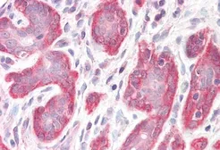 Anti-PDLIM4 antibody, C-term used in IHC (Paraffin sections) (IHC-P). GTX26045