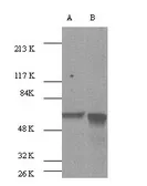 Anti-AKT antibody used in Western Blot (WB). GTX26076