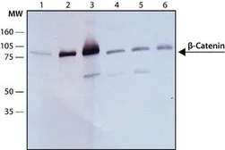 Anti-beta Catenin antibody [6F9] used in Western Blot (WB). GTX26300