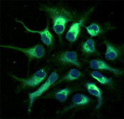 Anti-Nestin antibody [3k1] used in Immunocytochemistry/ Immunofluorescence (ICC/IF). GTX26320