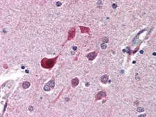Anti-CDK5 antibody used in IHC (Paraffin sections) (IHC-P). GTX26543