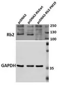 Anti-Rb2 / p130 antibody used in Western Blot (WB). GTX26545