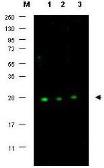 Anti-p27 Kip1 antibody used in Western Blot (WB). GTX26547