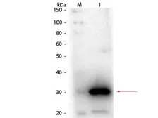 Anti-Carbonic Anhydrase 1 antibody used in Western Blot (WB). GTX26619