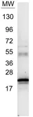 Anti-IL6 antibody used in Western Blot (WB). GTX26672