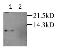 Anti-RANTES antibody used in Western Blot (WB). GTX27198
