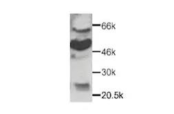 Anti-CX3CR1 antibody used in Western Blot (WB). GTX27201