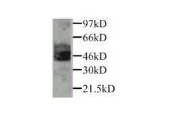 Anti-PAI-1 antibody used in Western Blot (WB). GTX27205