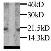 Anti-Leptin antibody used in Western Blot (WB). GTX27210